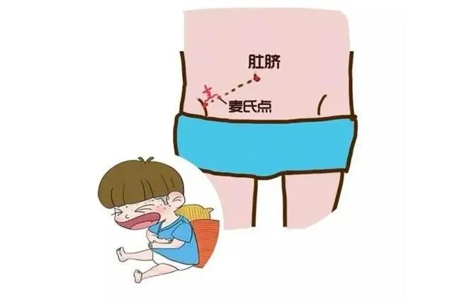 闌尾炎的三大壓痛點(diǎn)圖片解析及應(yīng)對(duì)方法，闌尾炎三大壓痛點(diǎn)圖片解析與應(yīng)對(duì)方法指南