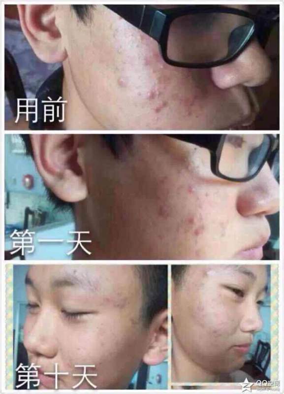 方法與技巧