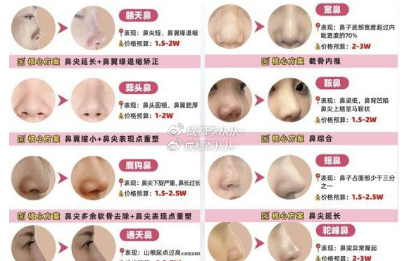 做鼻子整形手術(shù)的費(fèi)用詳解，大概價(jià)格多少？，鼻子整形手術(shù)費(fèi)用詳解，了解鼻子整形大概價(jià)格