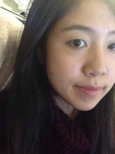 埋線雙眼皮多久恢復自然呢？全面解析恢復時間與過程，埋線雙眼皮恢復時間與過程全面解析，多久可自然恢復？