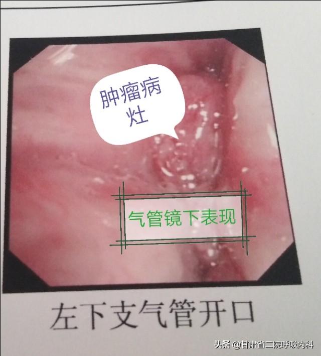 女性內(nèi)唇兩側(cè)瘙癢怎么辦——成因解析與應(yīng)對方法，女性內(nèi)唇兩側(cè)瘙癢，成因解析及應(yīng)對方法