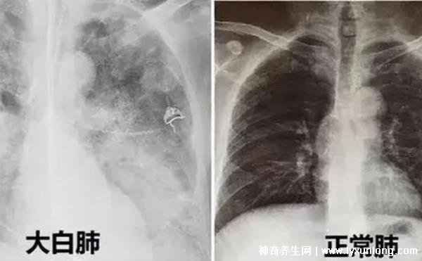laiyating 第8頁