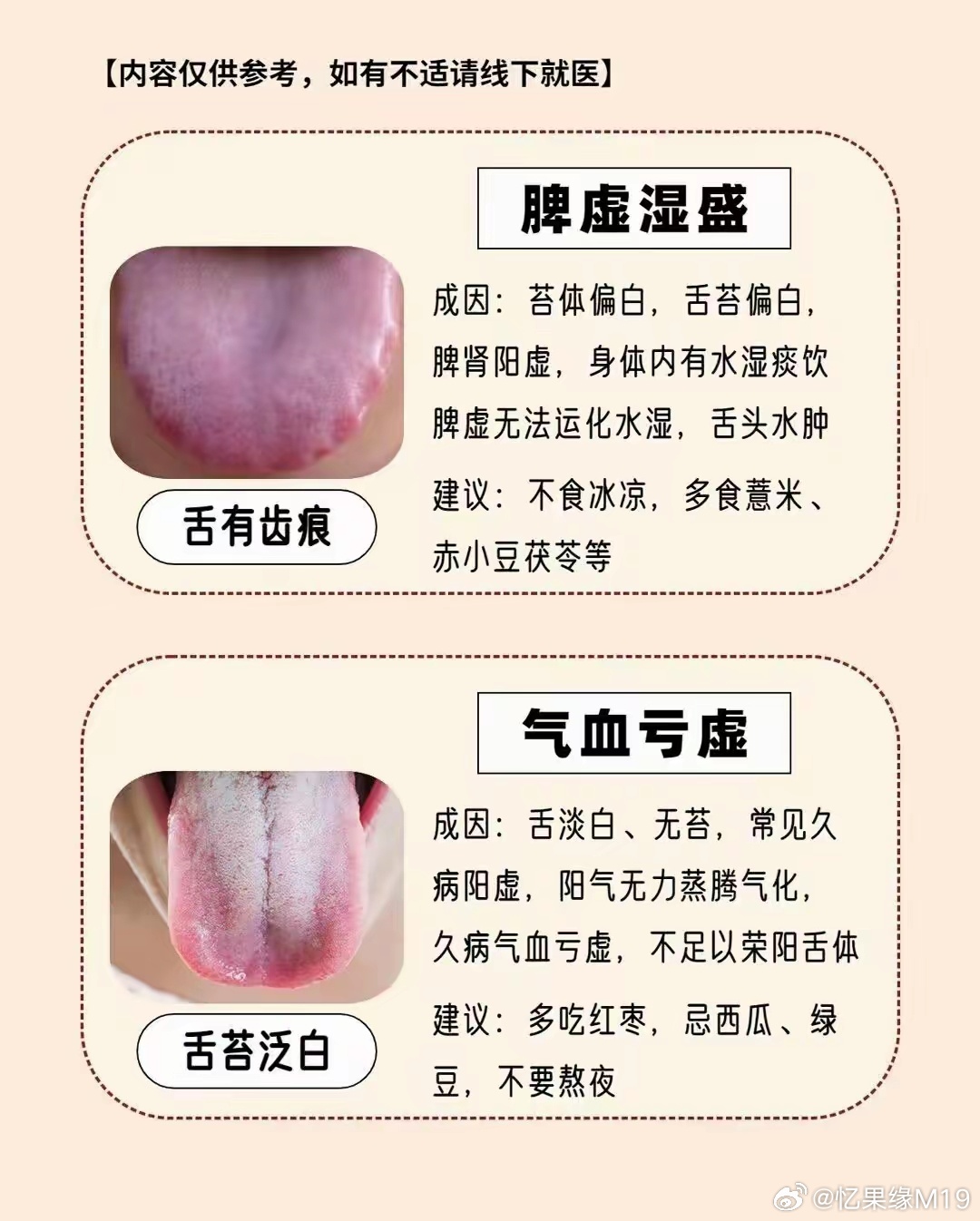 脾胃虛寒與脾胃濕熱的區(qū)別，深入了解兩種常見脾胃問題，脾胃虛寒與脾胃濕熱的差異，深入了解兩種常見脾胃問題探究