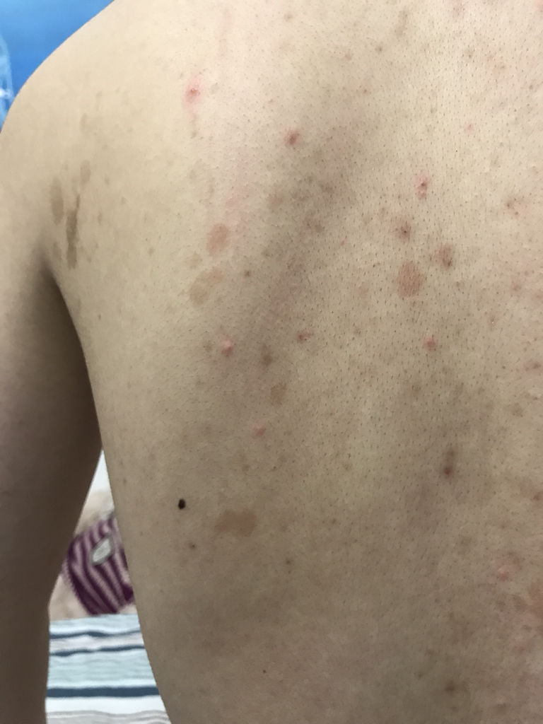 女性梅毒的十大征兆，了解并預(yù)防，女性梅毒的十大征兆詳解，預(yù)防與識(shí)別指南