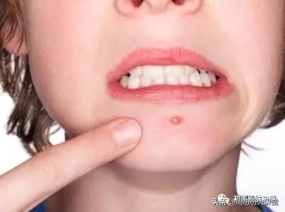 應(yīng)對方法與策略