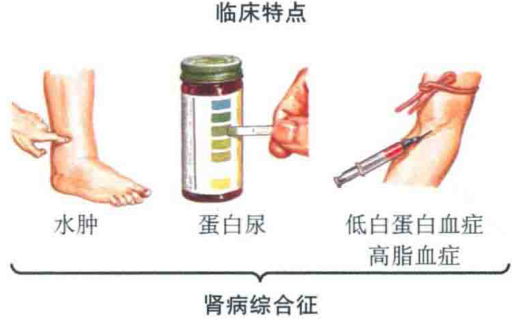 疾病概述