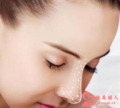 假體隆鼻，持久效果與多年維持的秘密，揭秘假體隆鼻，持久效果的秘密與多年維持之道