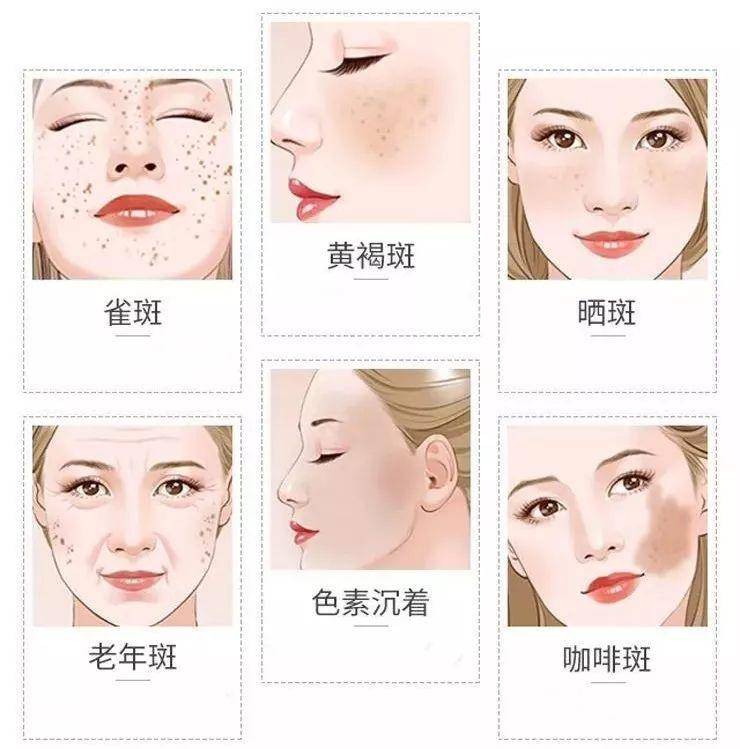 臉上長斑怎么內(nèi)調(diào)效果好，臉上長斑如何進(jìn)行有效的內(nèi)部調(diào)理？