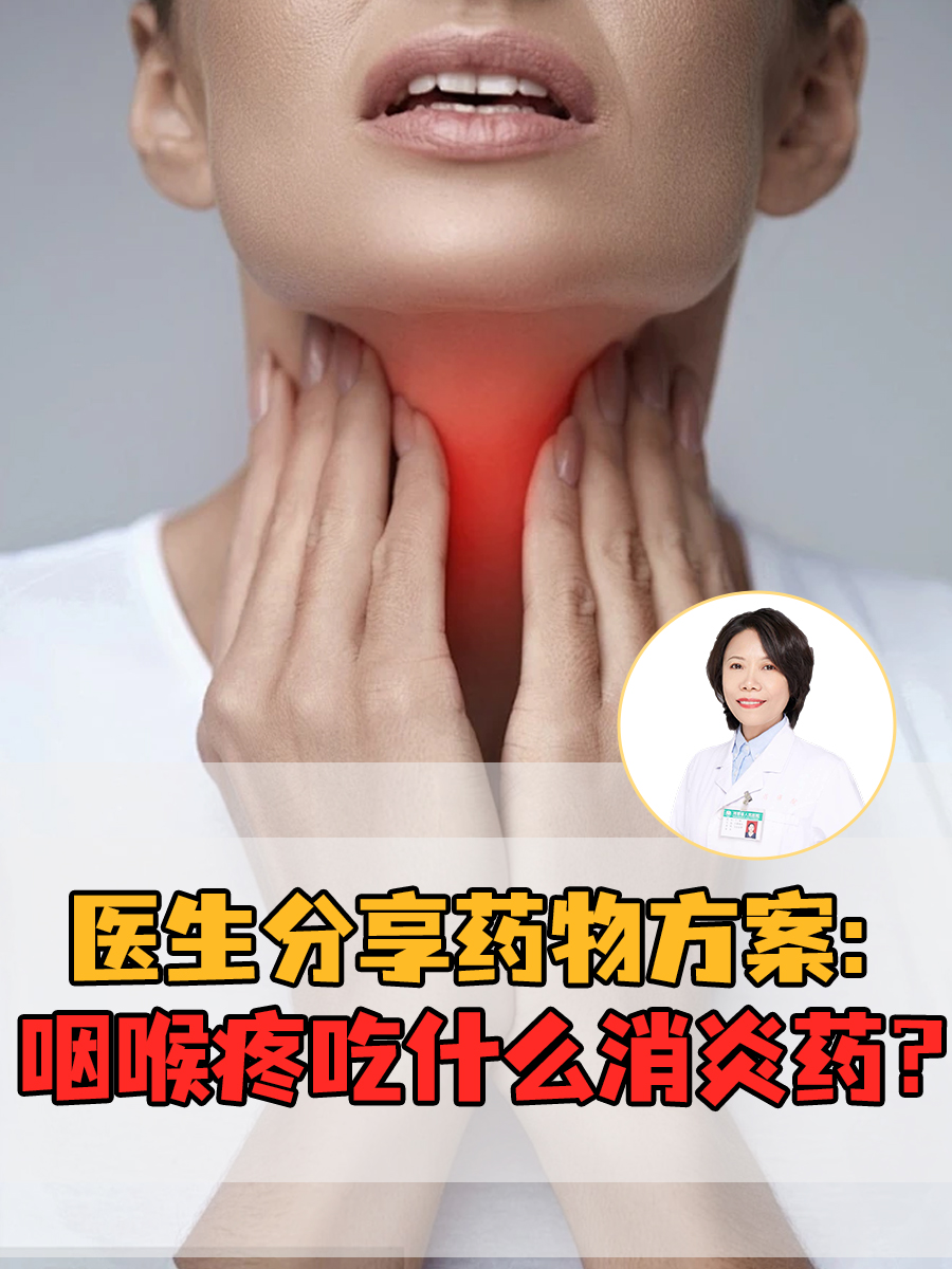 喉嚨痛最好的消炎藥，全面解析與選擇建議，喉嚨痛最佳消炎藥解析與選擇建議