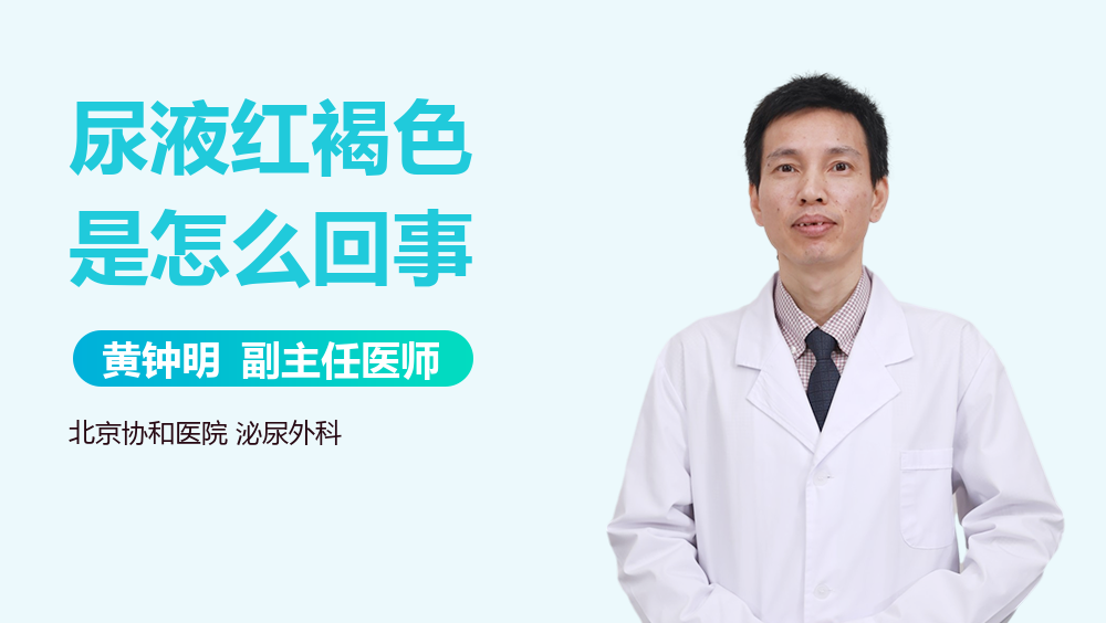 尿液發(fā)紅褐色怎么回事？解讀可能的健康信號，尿液發(fā)紅褐色原因解析，健康警示信號解讀