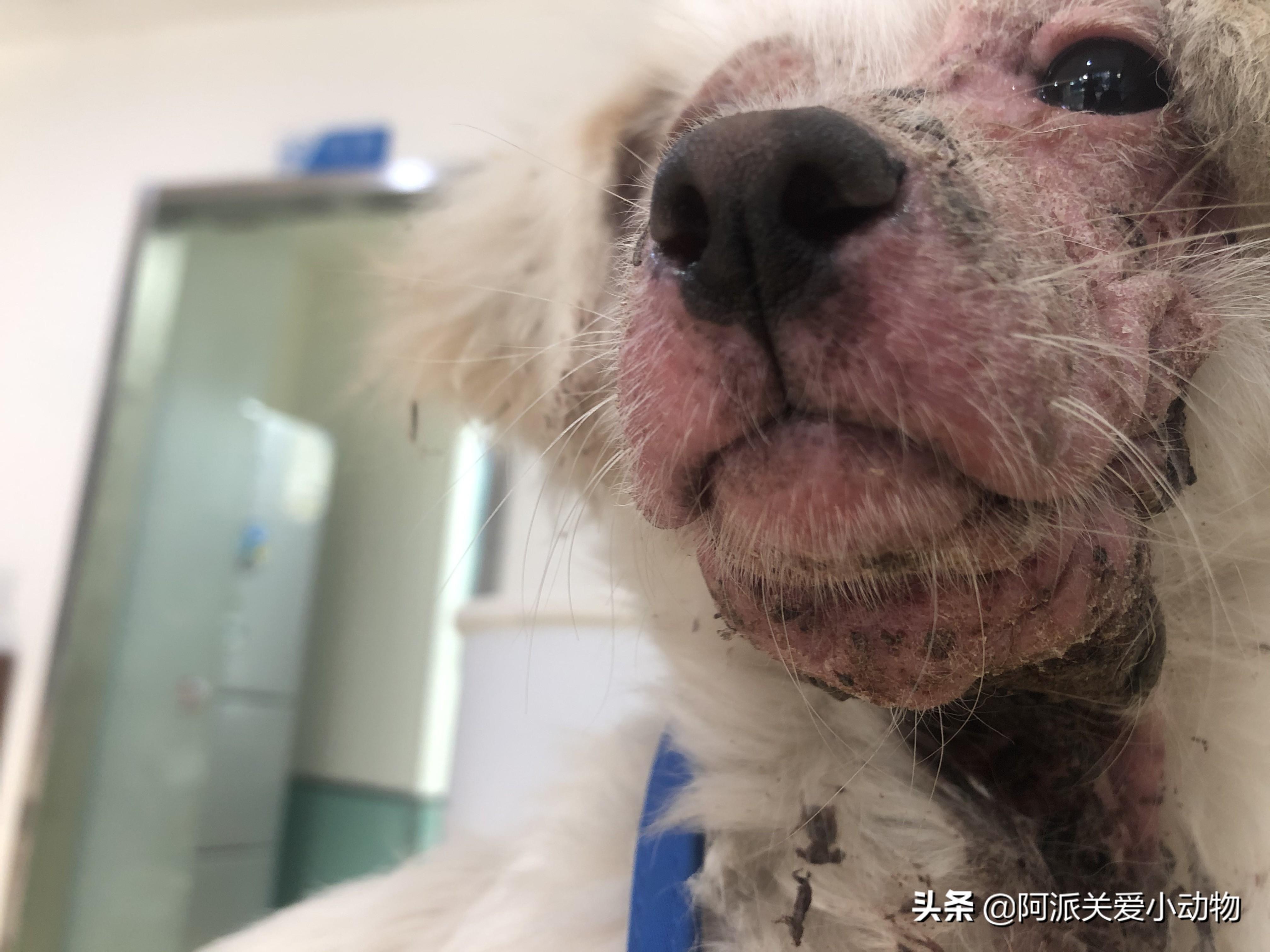 人身上被螨蟲(chóng)咬的癥狀與圖片解析，人體螨蟲(chóng)咬傷癥狀及圖片解析