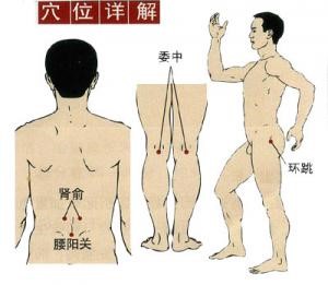 腰肌勞損治療最佳方法，全面解析有效療法，腰肌勞損最佳治療方法解析，全面有效的療法攻略