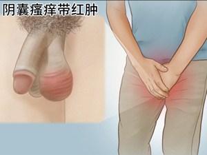 陰囊瘙癢，藥膏的選擇與應(yīng)用指南，陰囊瘙癢，藥膏選擇與應(yīng)用指南