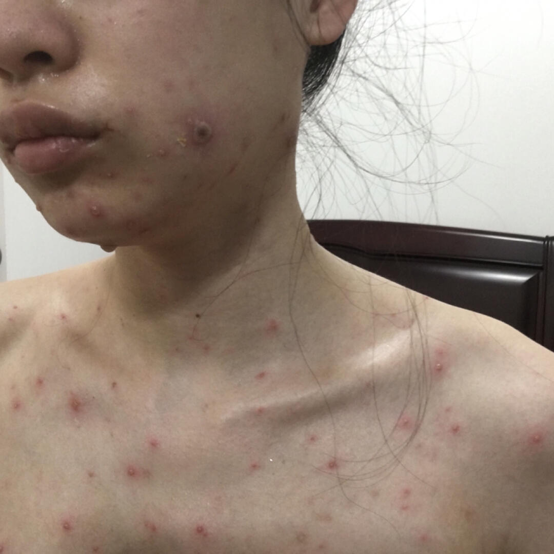 識別與防治