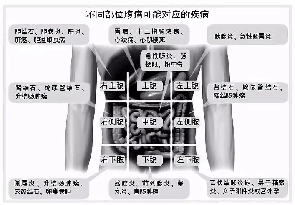 一張圖解析肚子痛的位置與原因，全面理解腹痛的奧秘，圖解肚子痛位置與原因，揭示腹痛奧秘的全面解析