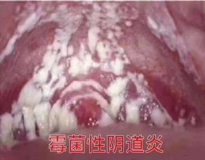 霉菌排出來(lái)的圖片，揭示霉菌的形態(tài)與影響，霉菌形態(tài)揭秘，圖片展示霉菌外貌及其影響