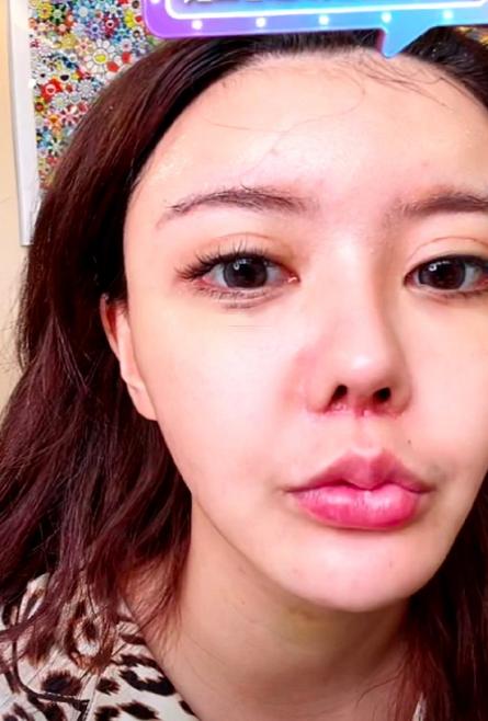 整容臉圖片，探索美的定義與界限，整容臉圖片，探索美的定義與界限之美
