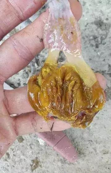 如何讓霉菌徹底排出——全面解析霉菌清除方法，全面解析，如何徹底排除霉菌的方法