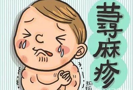蕁麻疹