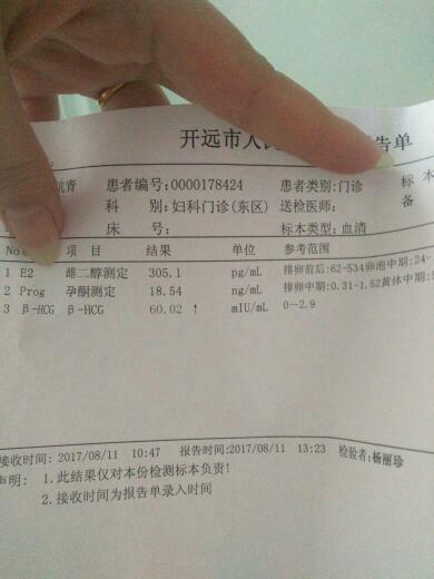 關于月經前是否會出現(xiàn)一深一淺的現(xiàn)象解析，月經前一深一淺現(xiàn)象解析