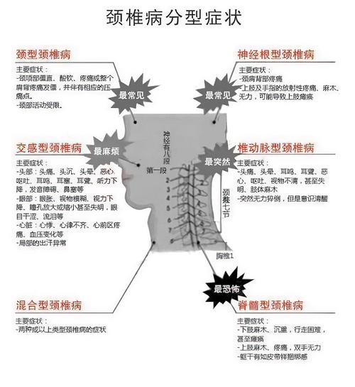 頸椎病的癥狀，了解、預(yù)防與應(yīng)對，頸椎病癥狀解析，了解、預(yù)防與應(yīng)對策略