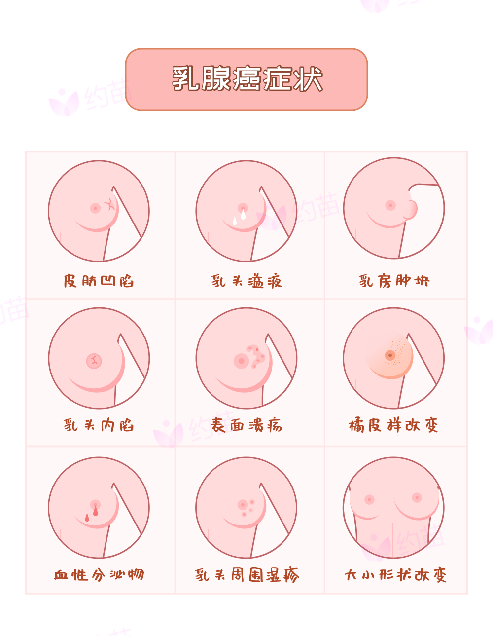 關(guān)于乳房中部捏著有一圈硬塊的分析與解讀，乳房中部捏感硬塊解析，原因與處理方法
