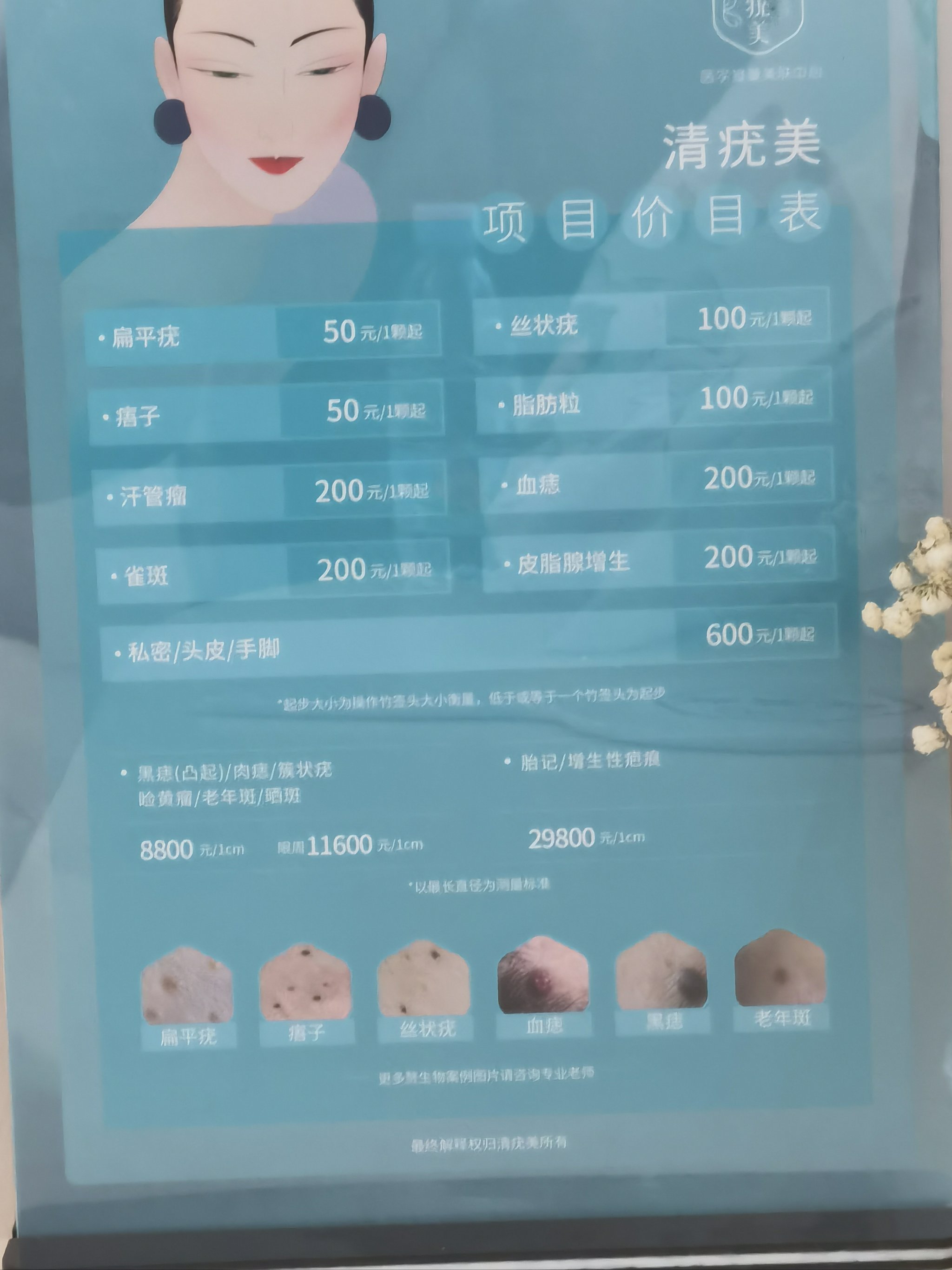 費(fèi)用及影響因素