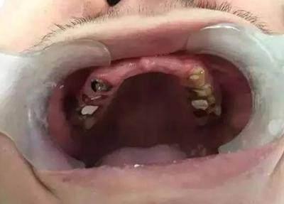 口腔科在線咨詢免費(fèi)，專業(yè)解答您的口腔問(wèn)題，口腔科在線免費(fèi)咨詢，專業(yè)解答口腔問(wèn)題