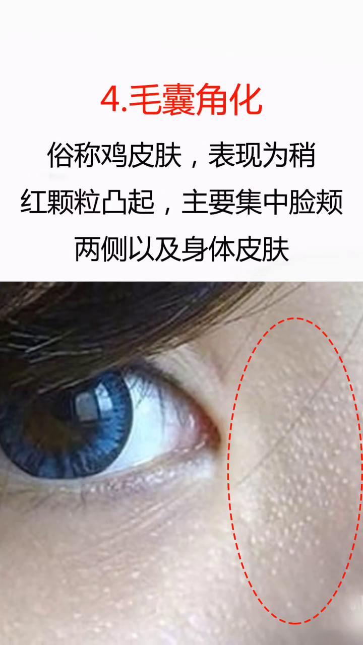 吃什么內(nèi)調(diào)美白去黃氣——打造肌膚自然光彩的秘訣，揭秘美白去黃氣食譜，內(nèi)調(diào)飲食打造肌膚自然光彩的秘訣