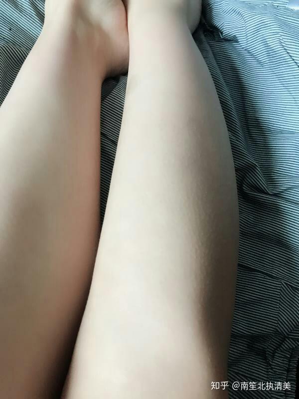 永久脫毛不再長，方法與注意事項，永久脫毛不再長，方法與注意事項詳解