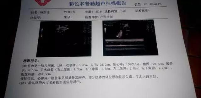 四維彩超