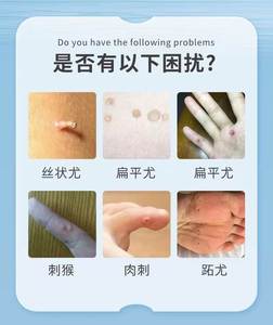 肉粒與疣的區(qū)別，深入了解兩者之間的差異，肉粒與疣的區(qū)別解析，深入了解兩者差異