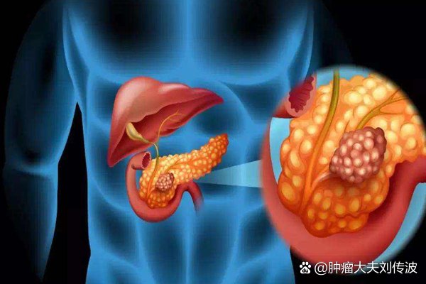 惡化最快的三大癌癥，認(rèn)識(shí)與防治的重要性，惡化最快的三大癌癥，認(rèn)識(shí)、防治至關(guān)重要