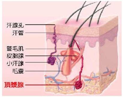 狐臭的最佳治療方法，狐臭的最佳治療方法探討