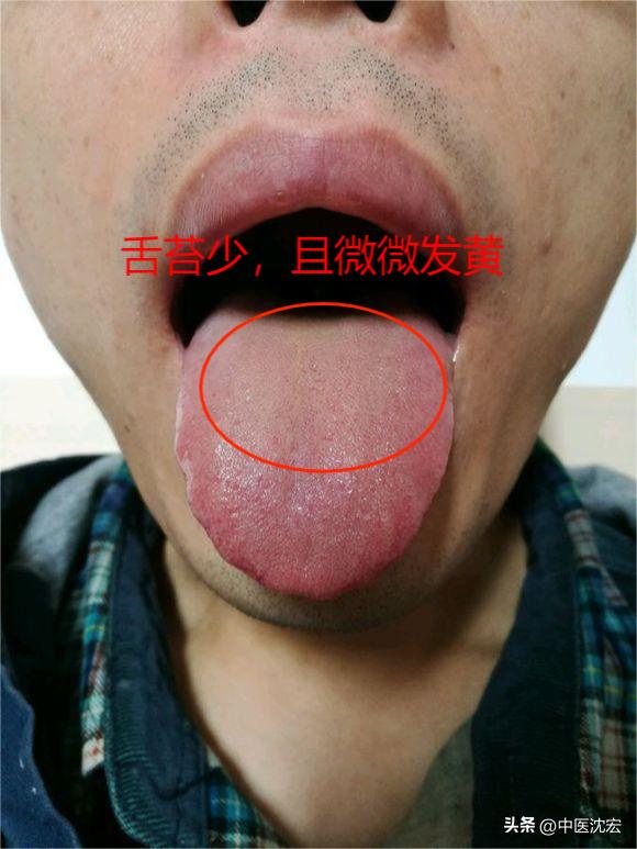 腎陽(yáng)虛的癥狀有哪些，全面解析與應(yīng)對(duì)之道，腎陽(yáng)虛癥狀全面解析及應(yīng)對(duì)方法