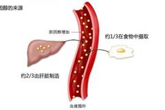 女性降膽固醇最好的方法，女性降低膽固醇的最佳方法