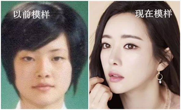 明星鼻子整容對(duì)比照，聚焦變化，揭示真相，明星鼻子整容前后對(duì)比，揭秘變化真相