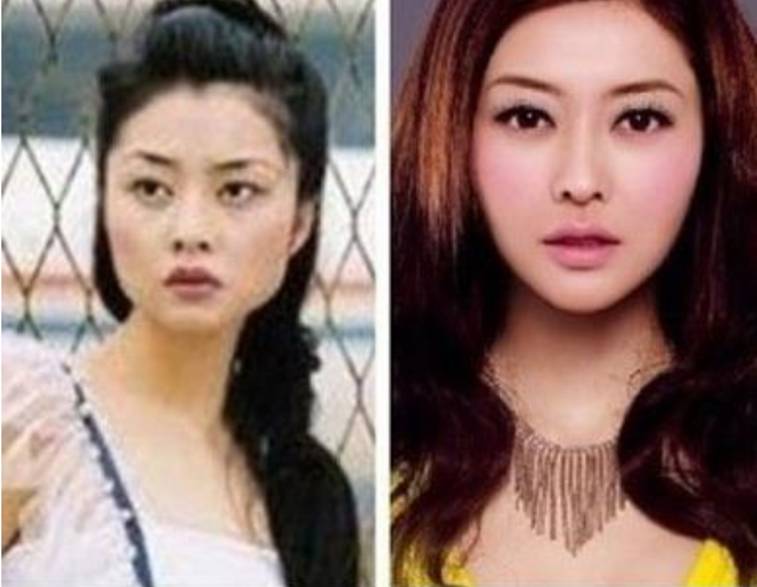 明星整容真相