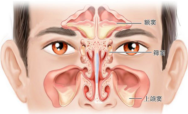 鼻炎的癥狀，全面解析與應(yīng)對方法，全面解析鼻炎癥狀及應(yīng)對方法