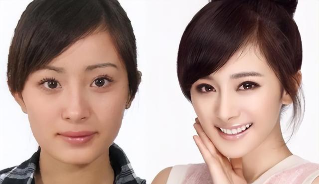 揭秘十大整容成功女明星背后的故事，揭秘十大整容成功女明星背后的故事與心路歷程