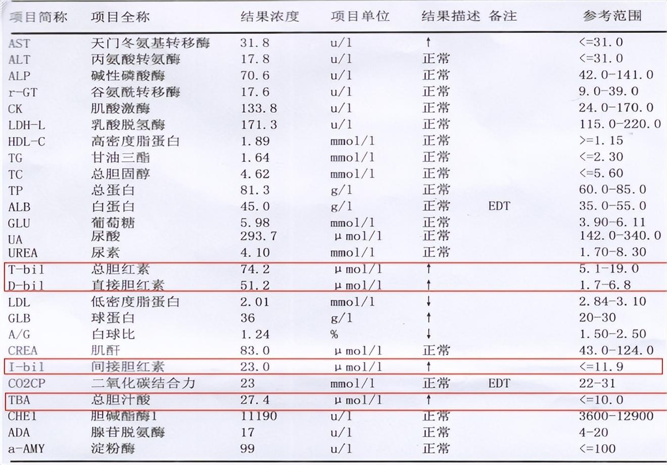 一分鐘看懂肝功化驗單，解讀肝功能檢查指標，一分鐘解讀肝功化驗單，肝功能檢查指標詳解