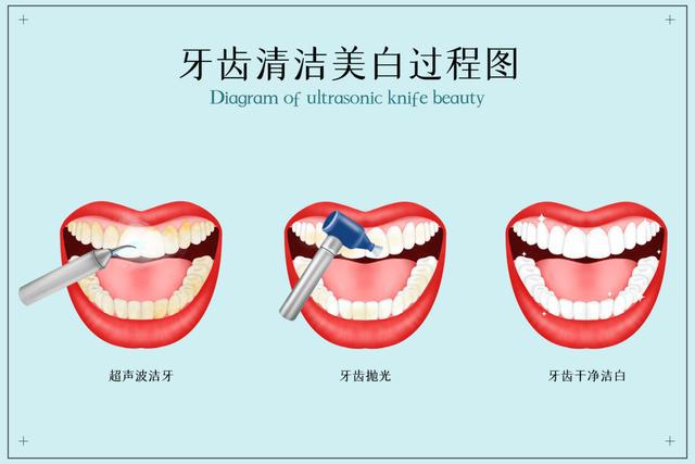 第一次洗牙的痛苦經(jīng)歷及其解析，首次洗牙的疼痛之旅與解析