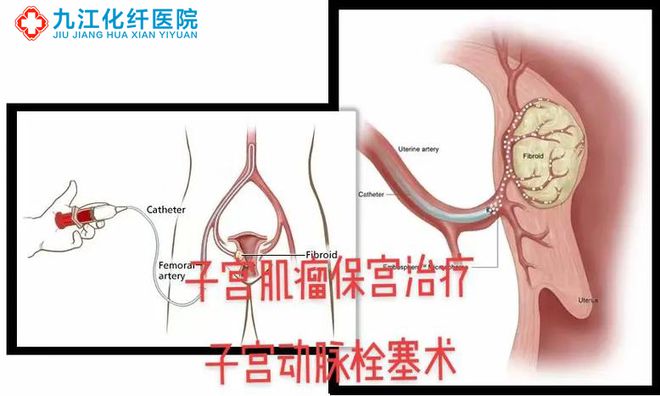 婦科病的常見癥狀及其識別，婦科病常見癥狀識別與解析