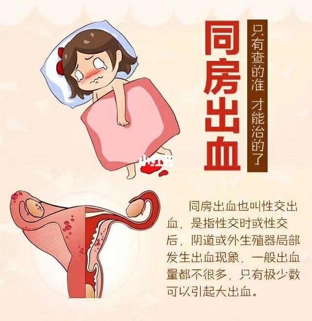 同房出血，原因解析與應對措施，同房出血原因解析及應對措施指南