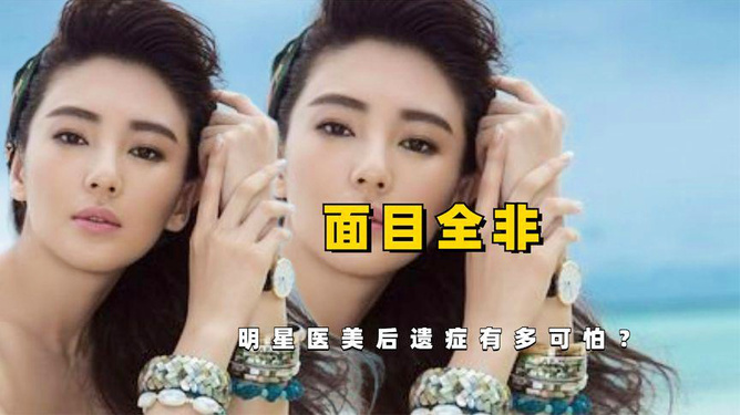 明星醫(yī)美前后對比，揭秘美麗的背后秘密，明星醫(yī)美前后對比，美麗背后的秘密大揭秘