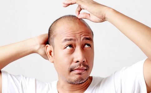 如何改善脫發(fā)問題，全方位解決方案，全方位解決方案，改善脫發(fā)問題的方法與技巧