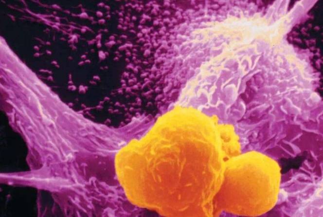 良性腫瘤的三大特征