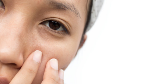 眼圈發(fā)黑警惕四種病，預(yù)防勝于治療，眼圈發(fā)黑警惕四種病，預(yù)防勝于治療策略